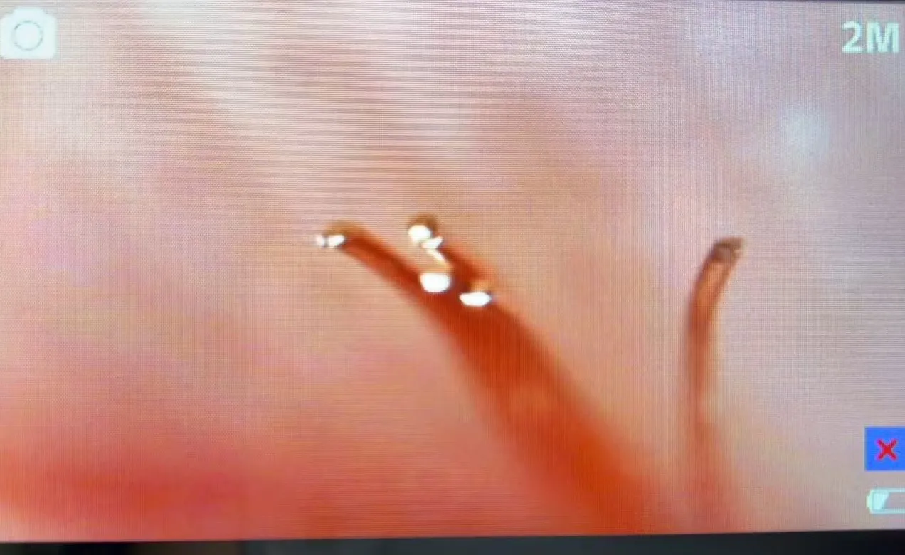 A single Ethernet conductor scraped under a microscope, copper-colored through the strands.