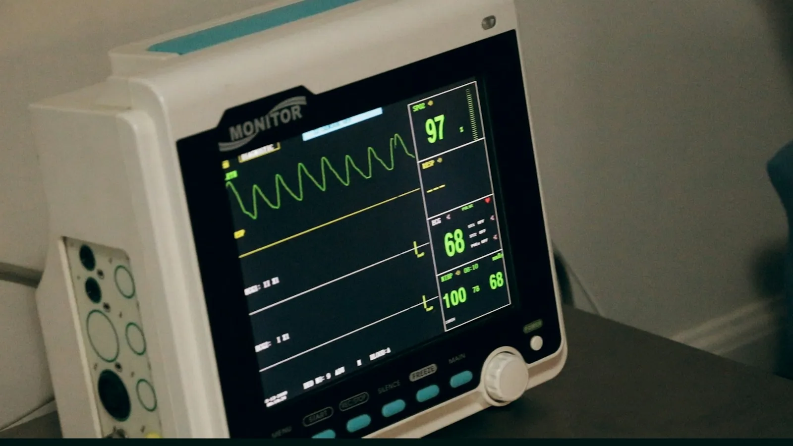 A patient monitor displaying vital-signs waveforms, with its patient-connection panel.